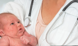 En Chiapas el sarampión se robó la navidad